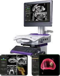 UroNav Invivo-Philips MRI-ultrasound fusion system for prostate biopsy